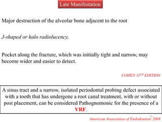 Late Manifestation
Major destruction of the alveolar bone adjacent to the root
J-shaped or halo radiolucency,
Pocket along the fracture, which was initially tight and narrow, may
become wider and easier to detect.
COHEN 11TH EDITION
A sinus tract and a narrow, isolated periodontal probing defect associated
with a tooth that has undergone a root canal treatment, with or without
post placement, can be considered Pathognomonic for the presence of a
VRF.
American Association of Endodontists 2008
19
 