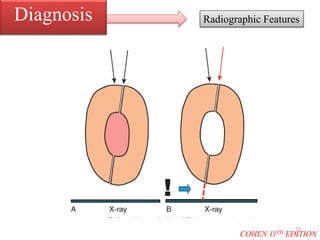 Radiographic FeaturesDiagnosis
COHEN 11TH EDITION
23
 