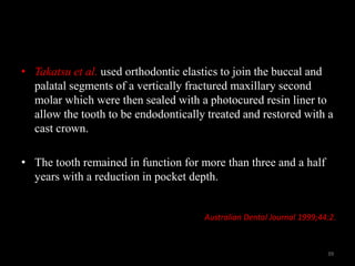 • Takatsu et al. used orthodontic elastics to join the buccal and
palatal segments of a vertically fractured maxillary second
molar which were then sealed with a photocured resin liner to
allow the tooth to be endodontically treated and restored with a
cast crown.
• The tooth remained in function for more than three and a half
years with a reduction in pocket depth.
Australian Dental Journal 1999;44:2.
39
 