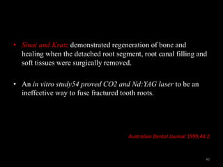 • Sinai and Kratz demonstrated regeneration of bone and
healing when the detached root segment, root canal filling and
soft tissues were surgically removed.
• An in vitro study54 proved CO2 and Nd:YAG laser to be an
ineffective way to fuse fractured tooth roots.
Australian Dental Journal 1999;44:2.
40
 