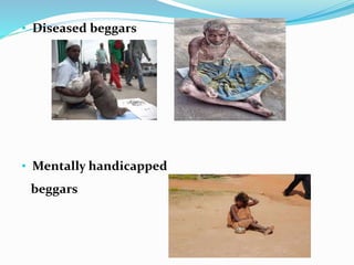 • Diseased beggars
• Mentally handicapped
beggars
 