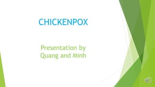 CHICKENPOX
Presentation by
Quang and Minh
 