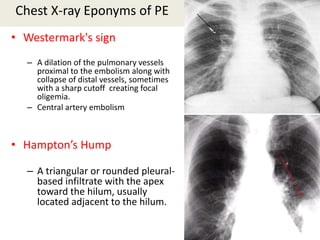 Watermark Sign Radiology deep vein thrombosis and pe | PPTX
