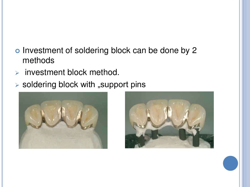 SOLDERINGWELDING AND ITS USE IN PROSTHODONTICS