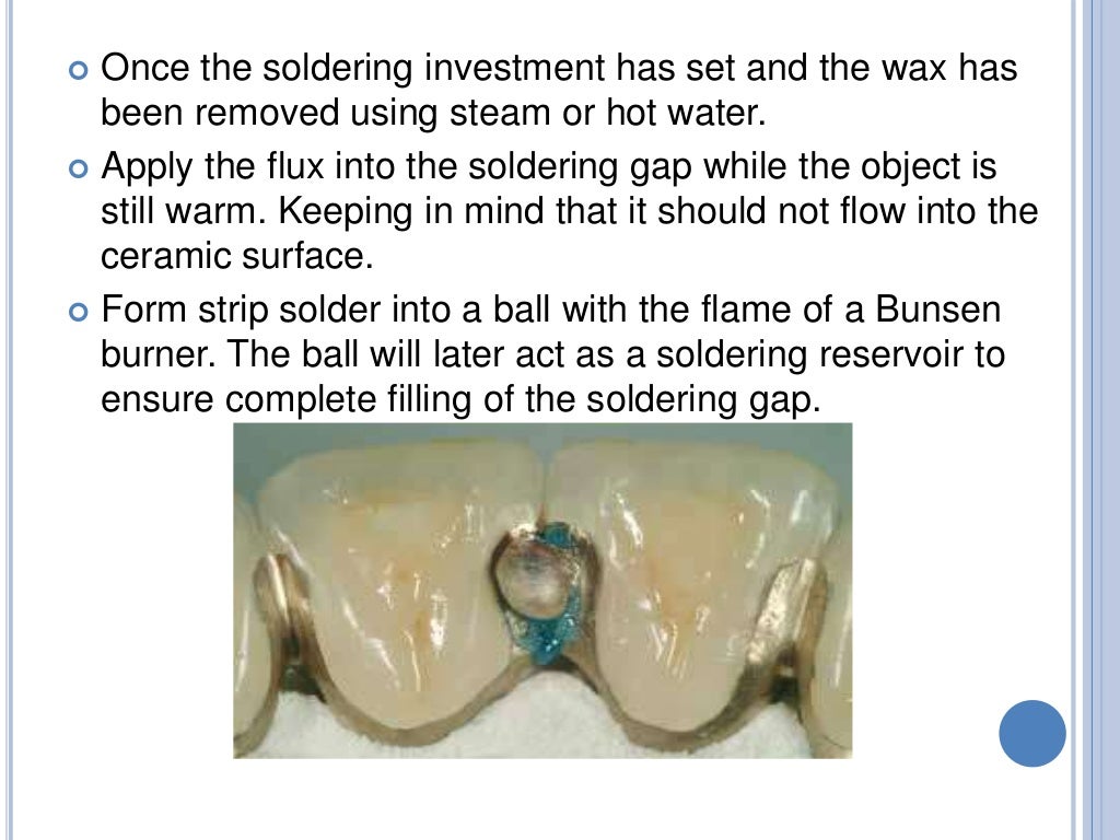 SOLDERINGWELDING AND ITS USE IN PROSTHODONTICS
