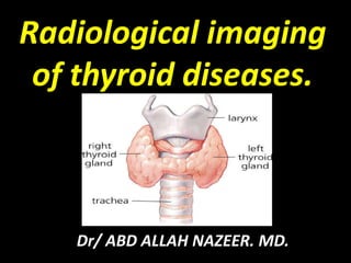 Radiological imaging
of thyroid diseases.
Dr/ ABD ALLAH NAZEER. MD.
 