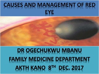 CAUSES AND MANAGEMENT OF RED
EYE
 