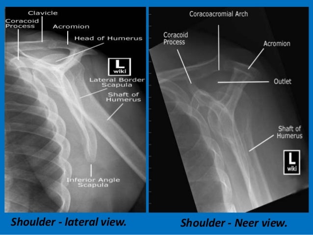 Presentation1.pptx. shoulder joint.