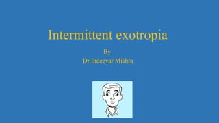 Intermittent exotropia
By
Dr Indeevar Mishra
 