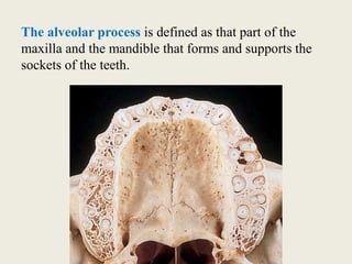 The alveolar process is defined as that part of the
maxilla and the mandible that forms and supports the
sockets of the teeth.
 