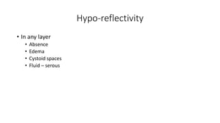Hypo-reflectivity
• In any layer
• Absence
• Edema
• Cystoid spaces
• Fluid – serous
 