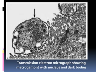 Transmission electron micrograph showing
macrogamont with nucleus and dark bodies
 
