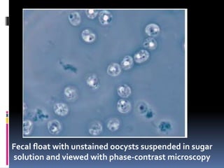 Fecal ﬂoat with unstained oocysts suspended in sugar
solution and viewed with phase-contrast microscopy
 