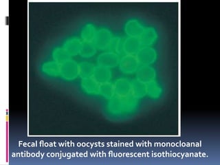 Fecal ﬂoat with oocysts stained with monocloanal
antibody conjugated with ﬂuorescent isothiocyanate.
 