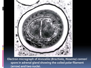 Electron micrograph of Anncaliia (Brachiola, Nosema) connori
spore in adrenal gland showing the coiled polar filament
(arrow) and two nuclei.
 