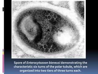 Spore of Enterocytozoon bieneusi demonstrating the
characteristic six turns of the polar tubule, which are
organized into two tiers of three turns each.
 