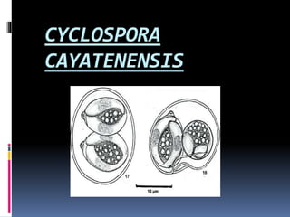 CYCLOSPORA
CAYATENENSIS
 