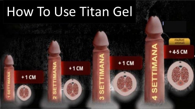 How To's Wiki 88: How To Use Titan Gel