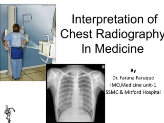 Interpretation of
Chest Radiography
ln Medicine
By
Dr. Farana Faruque
IMO,Medicine unit-1
SSMC & Mitford Hospital
 
