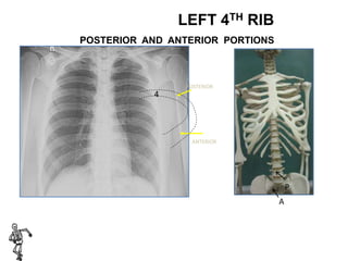 XRAY | PPTX