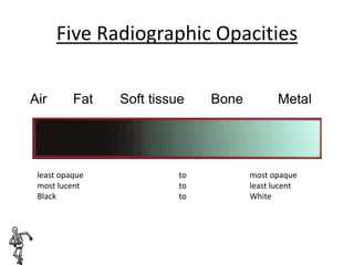 Mri Opacity XRAY | PPTX