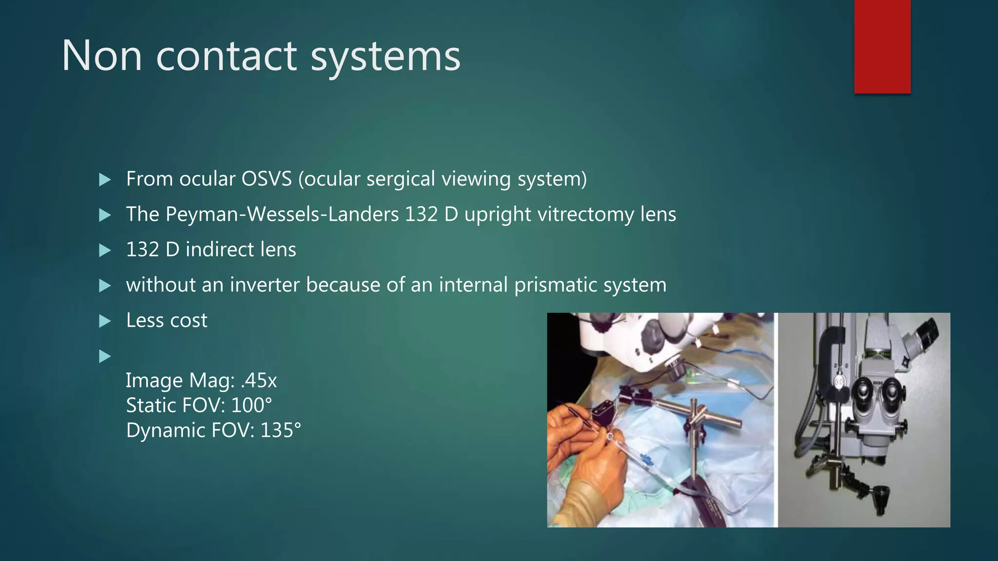 Vitrectomy Systems viewing systems in vitrectomy | PPTX