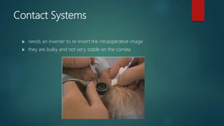 Contact Systems
 needs an inverter to re-invert the intraoperative image
 they are bulky and not very stable on the cornea
 