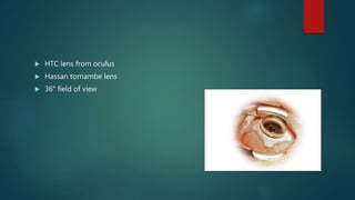  HTC lens from oculus
 Hassan tornambe lens
 36° field of view
 