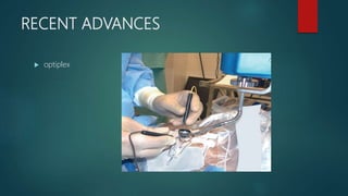 RECENT ADVANCES
 optiplex
 