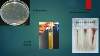 Solid medium
Semi-solid medium
Liquid
medium
 