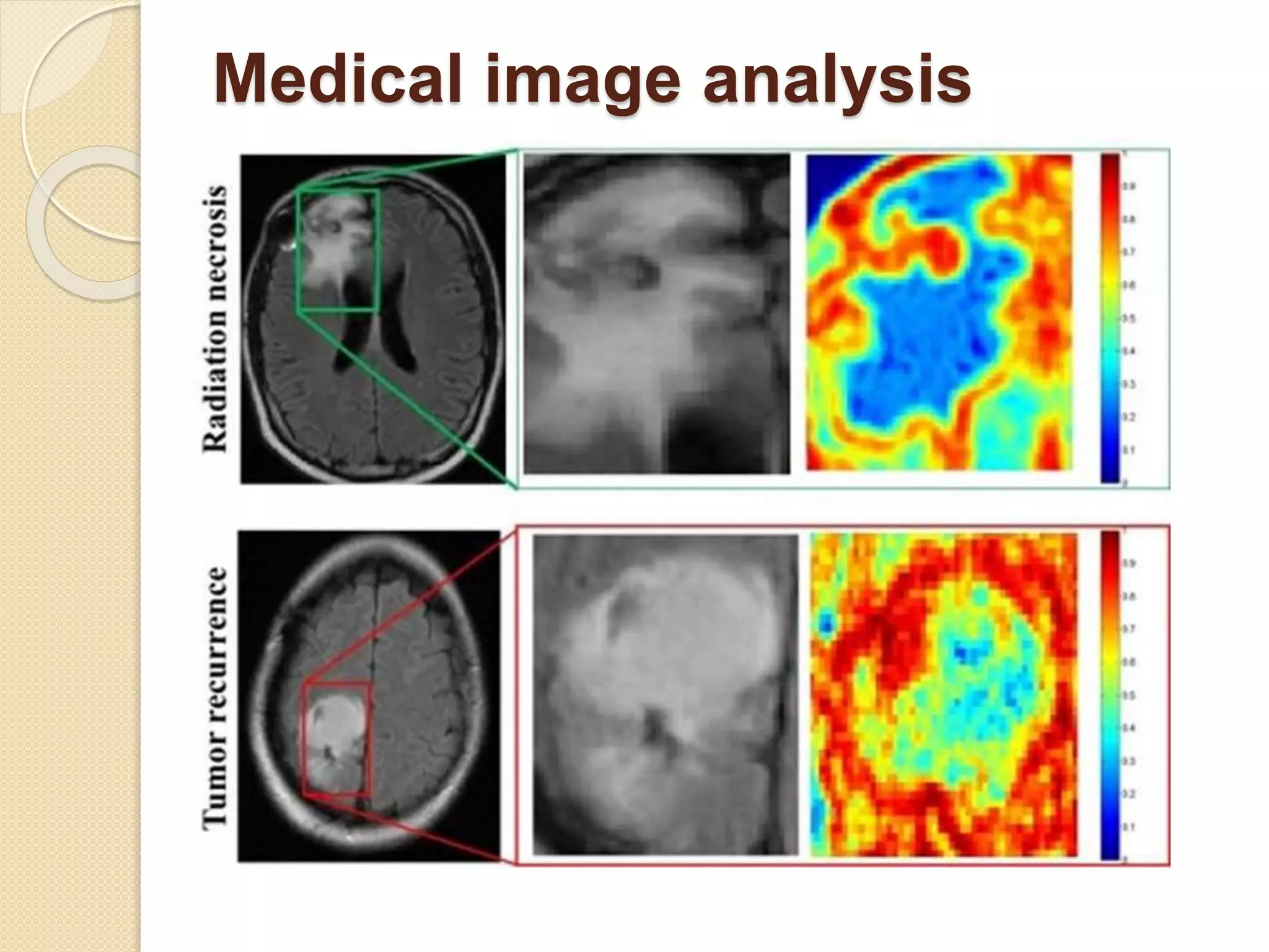Medical image analysis
 