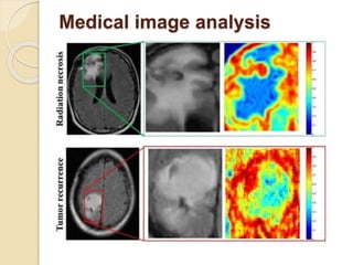 Medical image analysis
 
