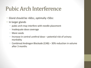 Pubic Arch Interference
• Gland should be <60cc, optimally <50cc
• In larger glands
• pubic arch may interfere with needle placement
• Inadequate dose coverage
• More seeds
• Increase in central urethral dose – potential risk of urinary
morbidity
• Combined Androgen Blockade (CAB) – 30% reduction in volume
after 3 months
 