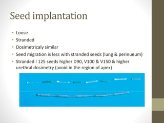 Seed implantation
• Loose
• Stranded
• Dosimetricaly similar
• Seed migration is less with stranded seeds (lung & perinueum)
• Stranded I 125 seeds higher D90, V100 & V150 & higher
urethral dosimetry (avoid in the region of apex)
 