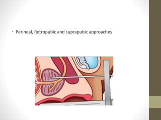 • Perineal, Retropubic and suprapubic approaches
 
