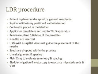LDR procedure
• Patient is placed under spinal or general anesthetia
• Supine in lithotomy position & catheterisation
• Contrast is placed in the bladder
• Applicator template is secured to TRUS apparatus
• Reference plane 0.0 (base of the prostate)
• Needles are inserted
• USG axial & sagittal views will guide the placement of the
needle
• Seeds are dropped within the prostate
• Lineal alignment & spacing
• Plain X ray to evaluate symmetry & spacing
• Bladder irrigation & cystoscopy to evacuate migrated seeds &
clots
 