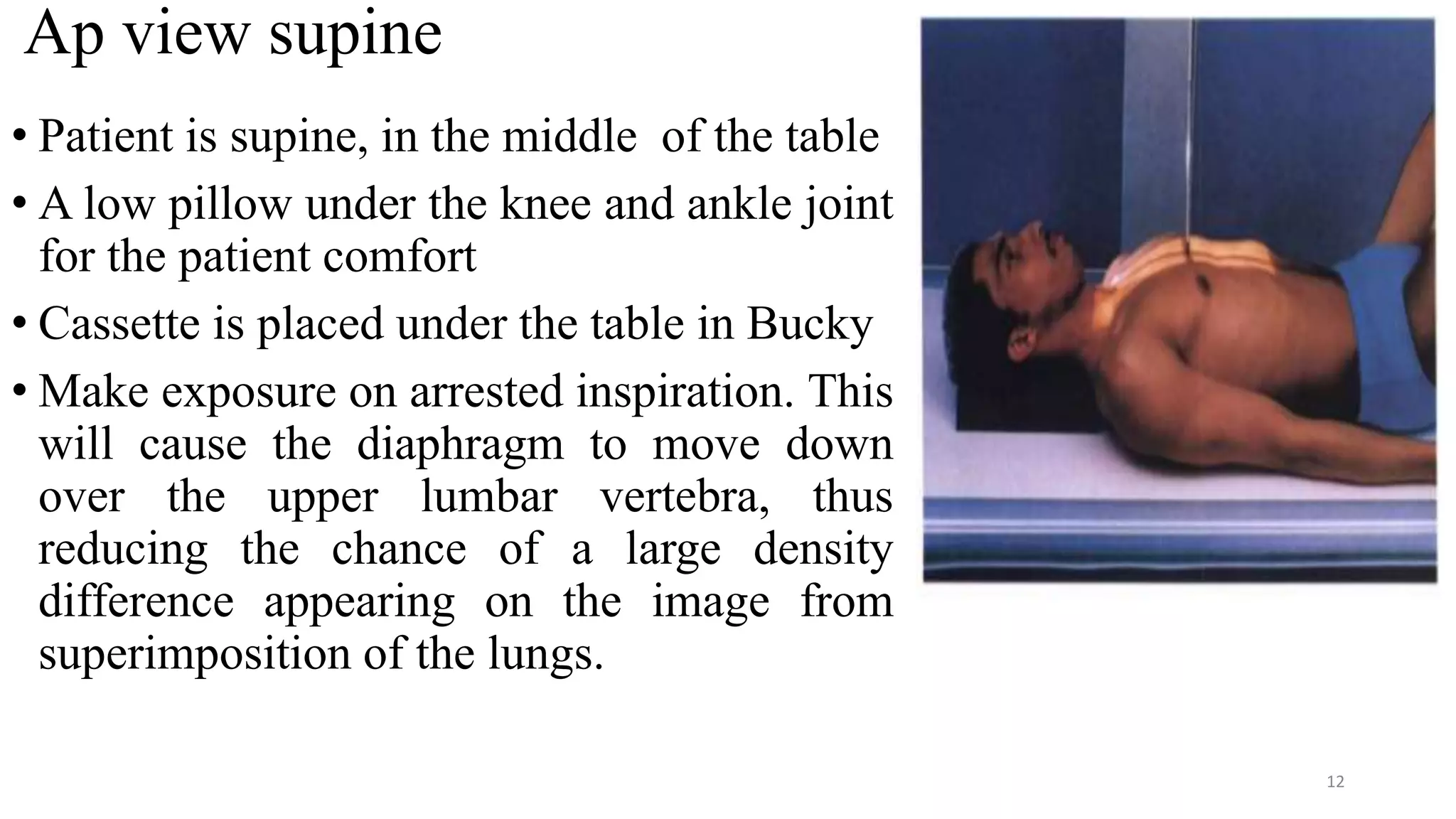 Ap view supine
• Patient is supine, in the middle of the table
• A low pillow under the knee and ankle joint
for the patient comfort
• Cassette is placed under the table in Bucky
• Make exposure on arrested inspiration. This
will cause the diaphragm to move down
over the upper lumbar vertebra, thus
reducing the chance of a large density
difference appearing on the image from
superimposition of the lungs.
12
 