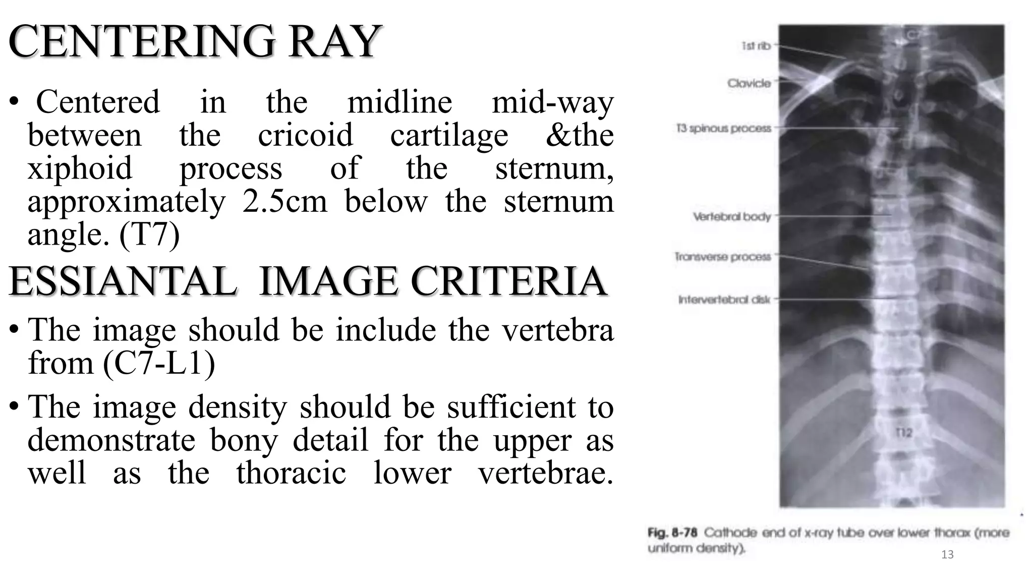 CENTERING RAY
• Centered in the midline mid-way
between the cricoid cartilage &the
xiphoid process of the sternum,
approximately 2.5cm below the sternum
angle. (T7)
ESSIANTAL IMAGE CRITERIA
• The image should be include the vertebra
from (C7-L1)
• The image density should be sufficient to
demonstrate bony detail for the upper as
well as the thoracic lower vertebrae.
13
 