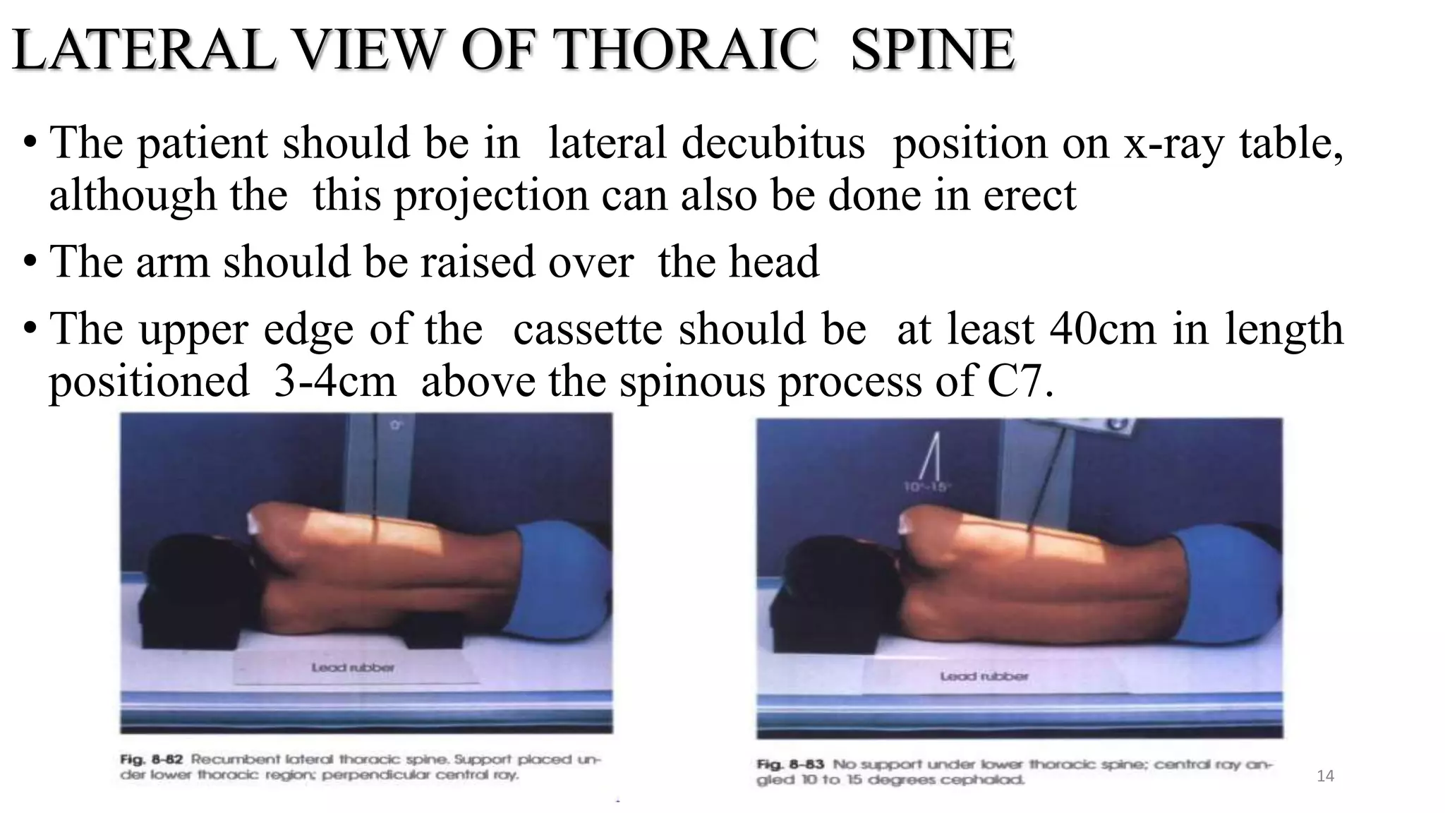 LATERAL VIEW OF THORAIC SPINE
• The patient should be in lateral decubitus position on x-ray table,
although the this projection can also be done in erect
• The arm should be raised over the head
• The upper edge of the cassette should be at least 40cm in length
positioned 3-4cm above the spinous process of C7.
14
 