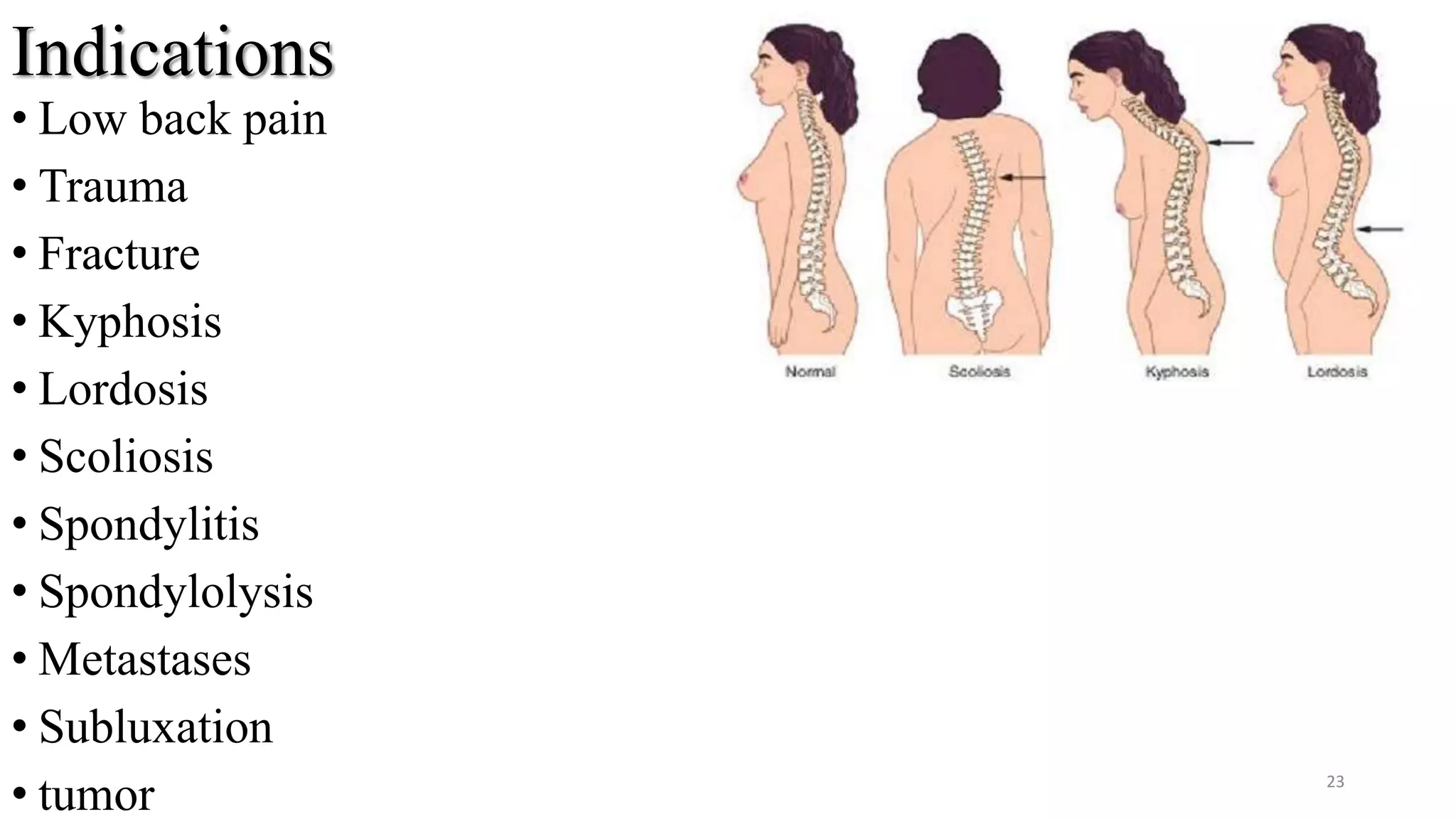 Indications
• Low back pain
• Trauma
• Fracture
• Kyphosis
• Lordosis
• Scoliosis
• Spondylitis
• Spondylolysis
• Metastases
• Subluxation
• tumor 23
 