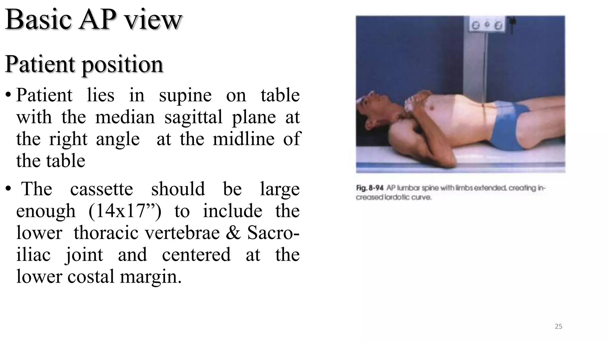 Basic AP view
Patient position
• Patient lies in supine on table
with the median sagittal plane at
the right angle at the midline of
the table
• The cassette should be large
enough (14x17”) to include the
lower thoracic vertebrae & Sacro-
iliac joint and centered at the
lower costal margin.
25
 