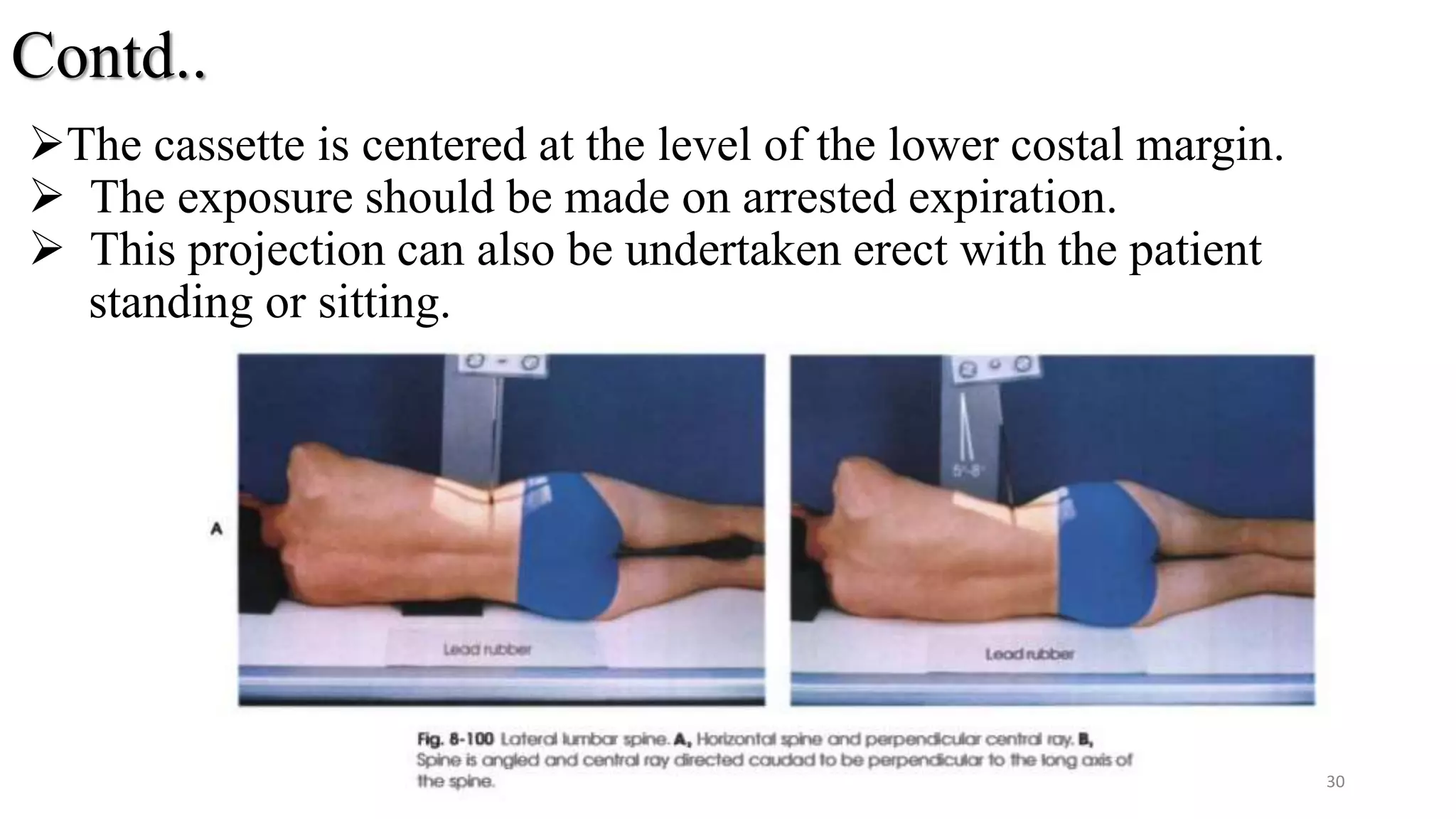 Contd..
The cassette is centered at the level of the lower costal margin.
 The exposure should be made on arrested expiration.
 This projection can also be undertaken erect with the patient
standing or sitting.
30
 