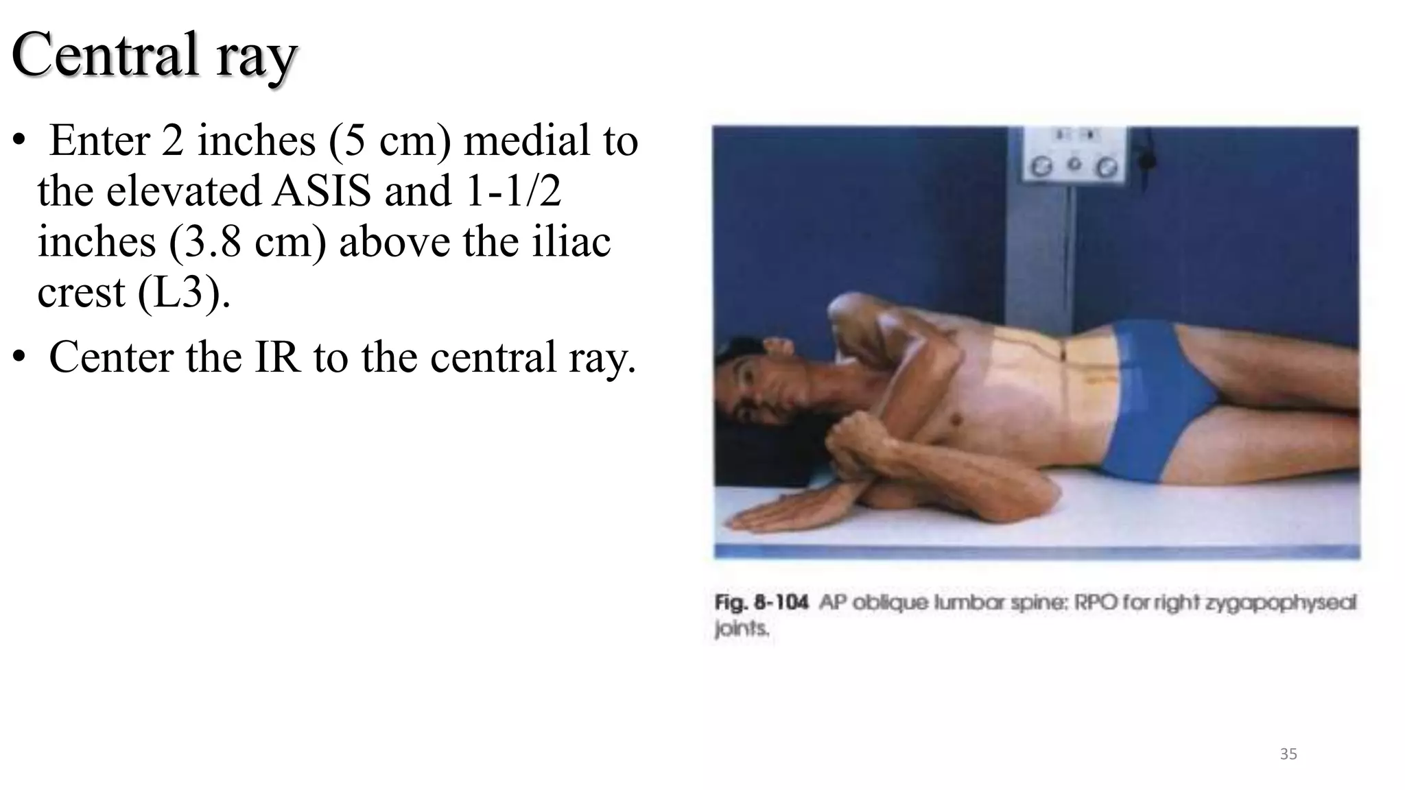 Central ray
• Enter 2 inches (5 cm) medial to
the elevated ASIS and 1-1/2
inches (3.8 cm) above the iliac
crest (L3).
• Center the IR to the central ray.
35
 