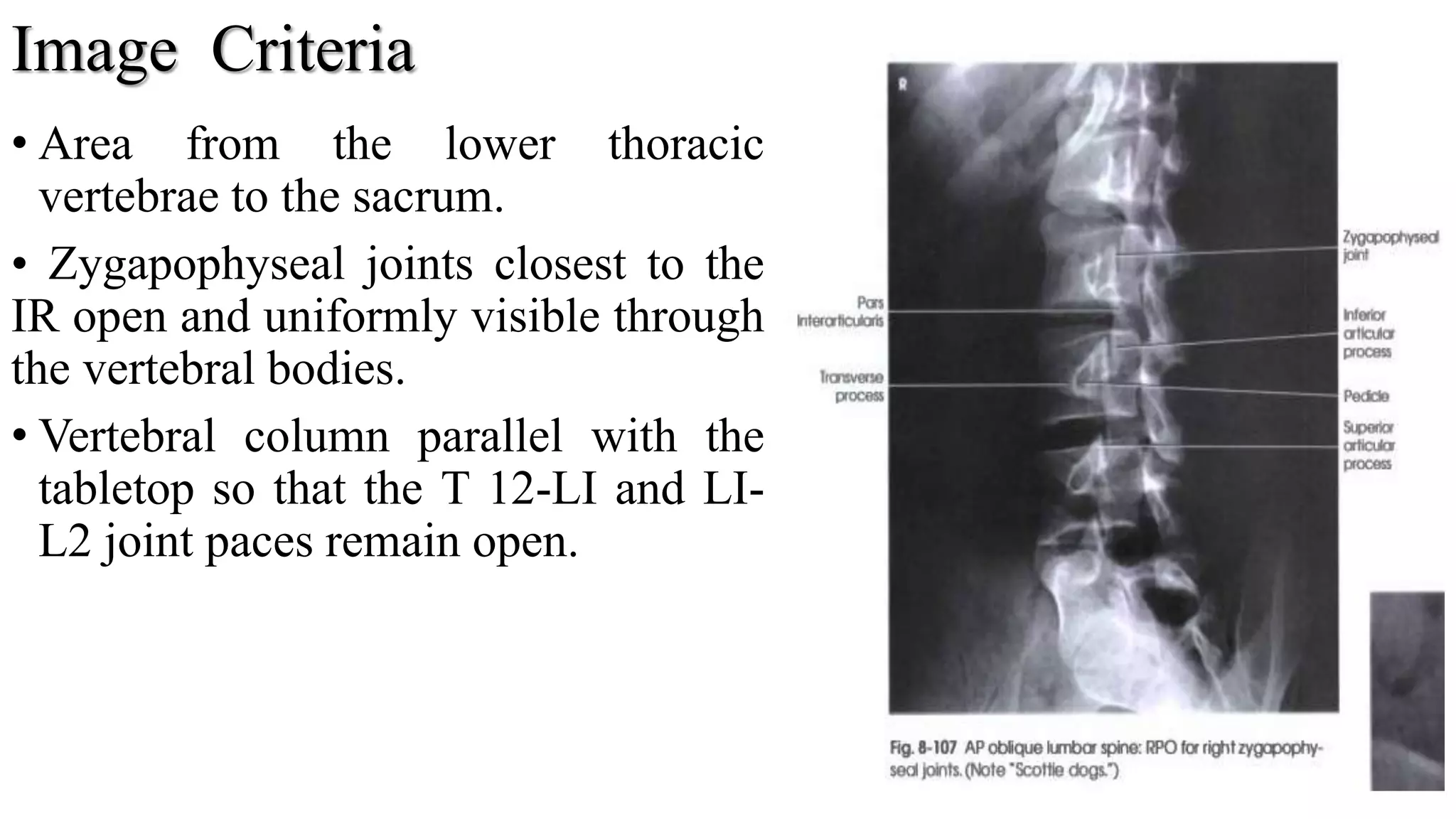 Image Criteria
• Area from the lower thoracic
vertebrae to the sacrum.
• Zygapophyseal joints closest to the
IR open and uniformly visible through
the vertebral bodies.
• Vertebral column parallel with the
tabletop so that the T 12-LI and LI-
L2 joint paces remain open.
37
 