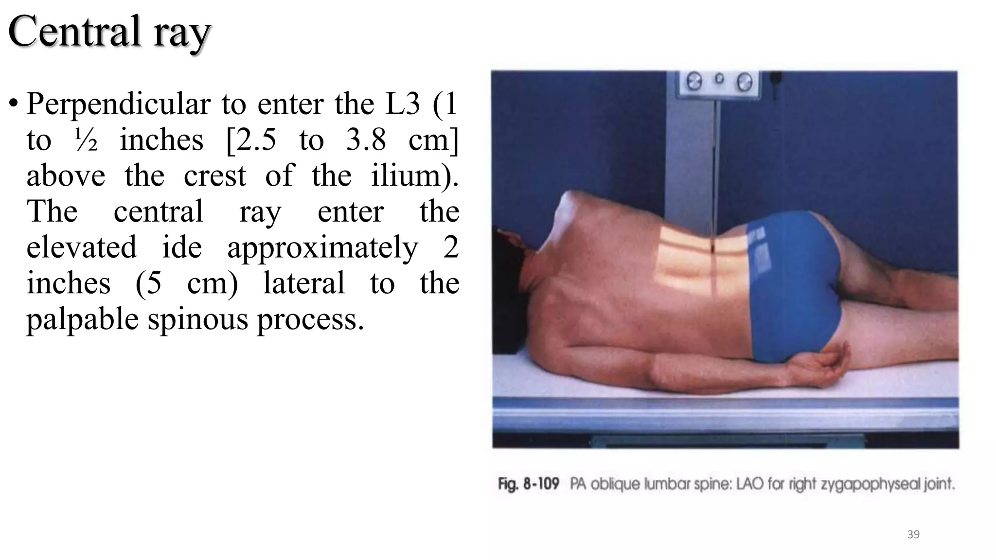 Central ray
• Perpendicular to enter the L3 (1
to ½ inches [2.5 to 3.8 cm]
above the crest of the ilium).
The central ray enter the
elevated ide approximately 2
inches (5 cm) lateral to the
palpable spinous process.
39
 
