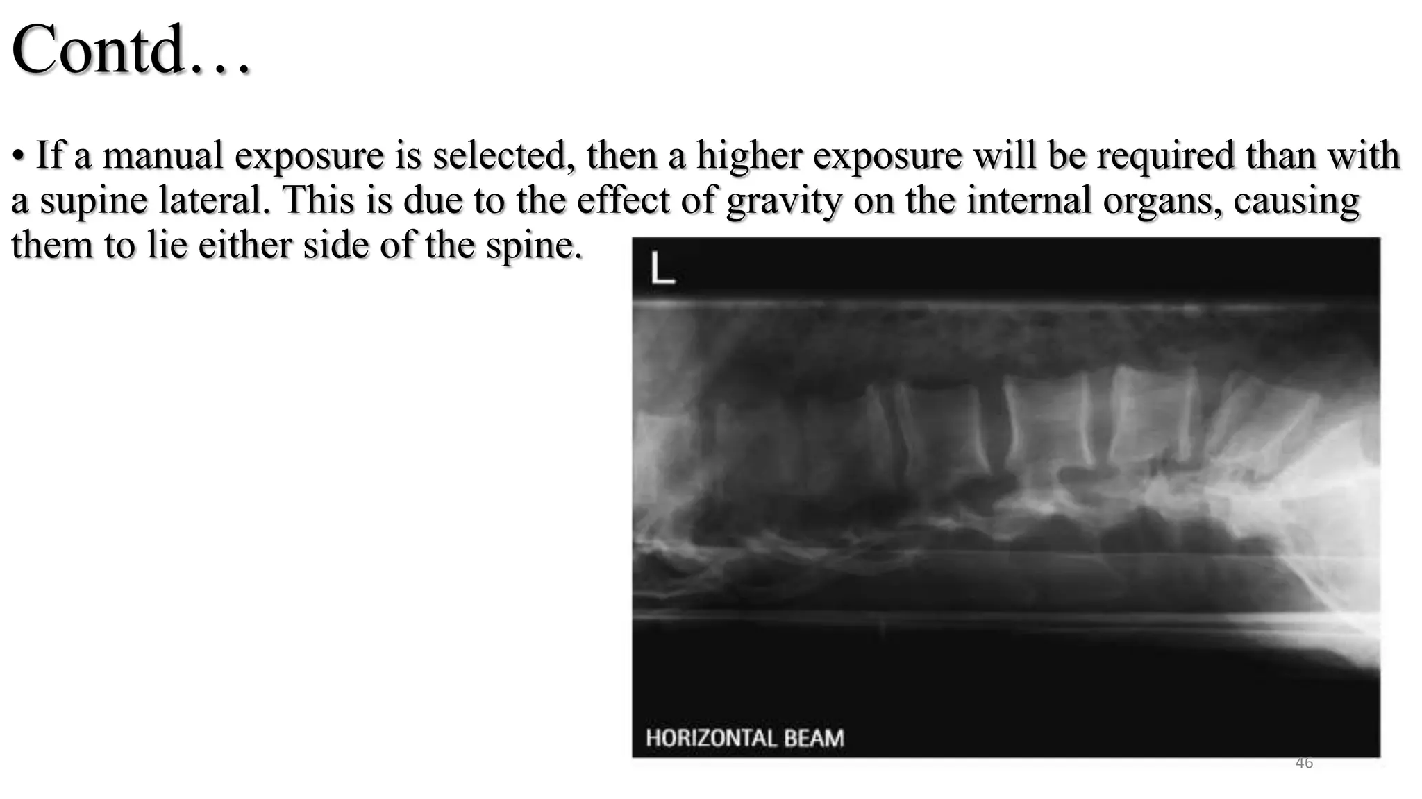 Contd…
• If a manual exposure is selected, then a higher exposure will be required than with
a supine lateral. This is due to the effect of gravity on the internal organs, causing
them to lie either side of the spine.
46
 