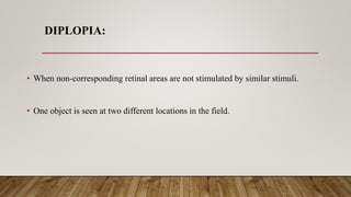 DIPLOPIA:
• When non-corresponding retinal areas are not stimulated by similar stimuli.
• One object is seen at two different locations in the field.
 