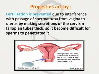 Progestins act by :
Fertilization is prevented due to interference
with passage of spermatozoa from vagina to
uterus by making secretions of the cervix n
fallopian tubes thick, so it become difficult for
sperms to penetrated it
 