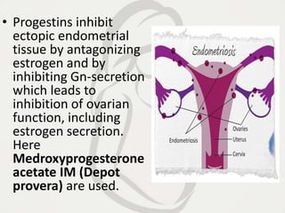• Progestins inhibit
ectopic endometrial
tissue by antagonizing
estrogen and by
inhibiting Gn-secretion
which leads to
inhibition of ovarian
function, including
estrogen secretion.
Here
Medroxyprogesterone
acetate IM (Depot
provera) are used.
 