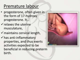 Premature labour
• progesterone, often given in
the form of 17-hydroxy
progesterone. It…
relaxes the uterine
musculature,
maintains cervical length,
has anti-inflammatory
properties, and thus exerts
activities expected to be
beneficial in reducing preterm
birth.
 